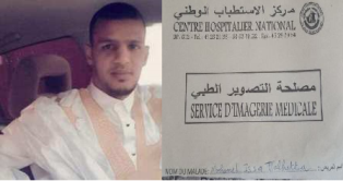 الشاب عيسى ولد طلحة الممارس عليه التعذيب رفقة ملفه الطبي كاملا