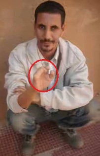 المواطن الشيخ ولد محمد الذي بترت اصابعه شركة MCM